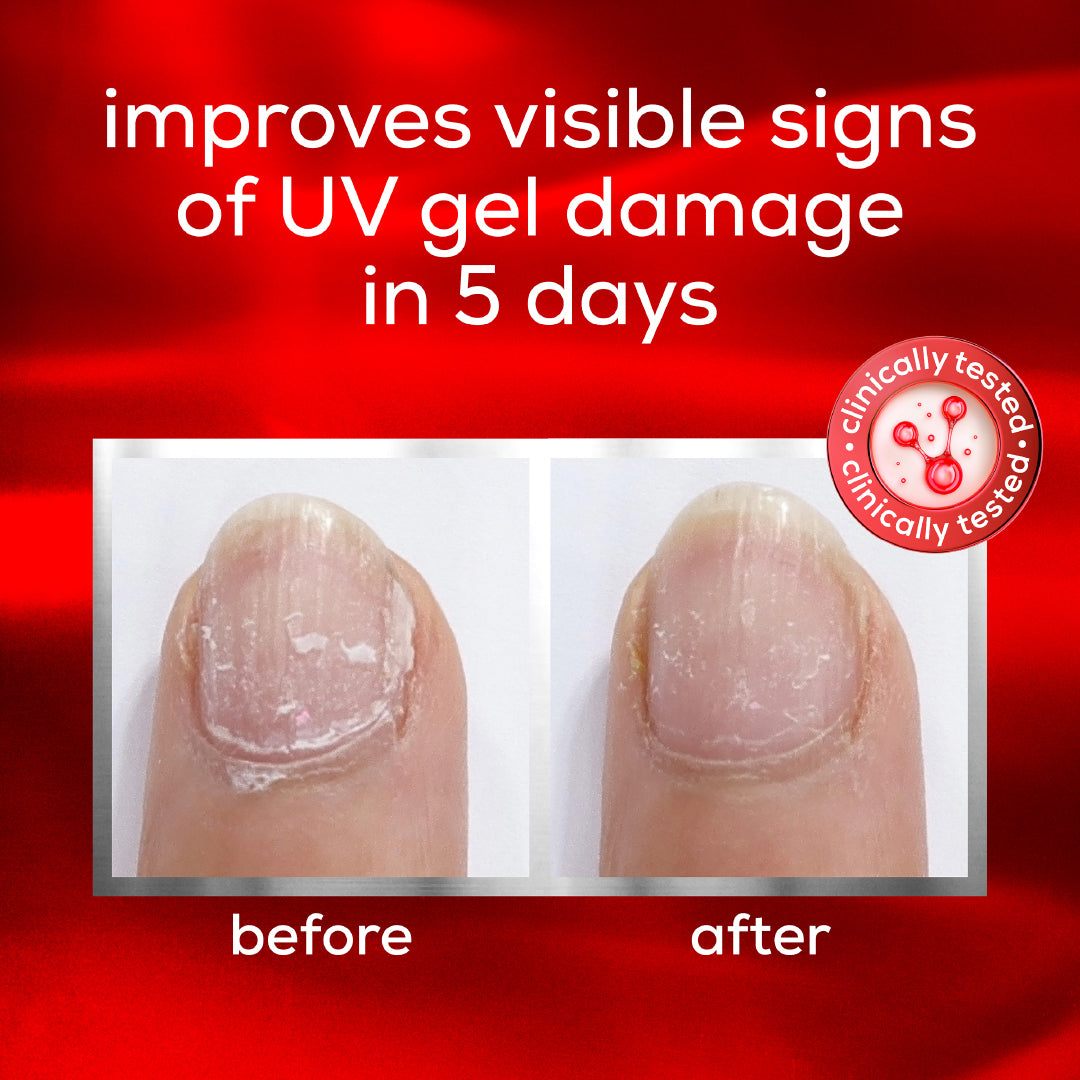 Essie Nail Care The Rescue - UV Gel Damage