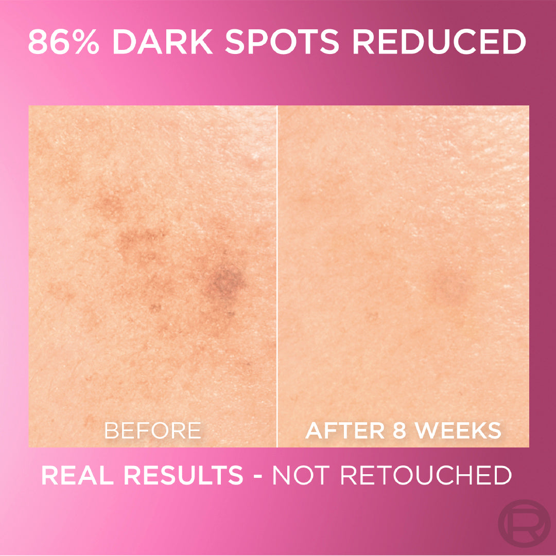 L'Oreal Paris Glyco bright Anti Dark Spot -Melasyl- Face Serum brightener